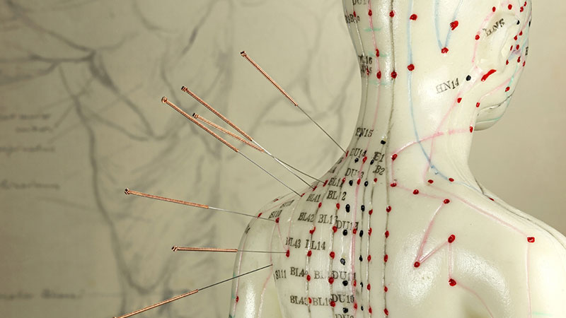 Traditional acupuncture points